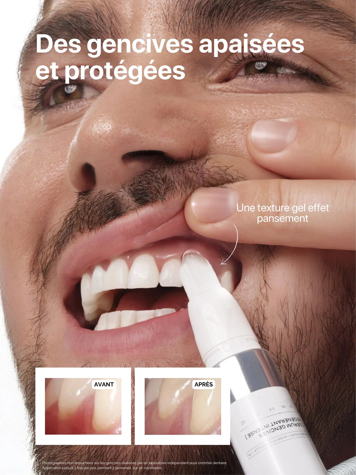 serum-gencives-regenerant-intense-the-smilist-maison-diaphane