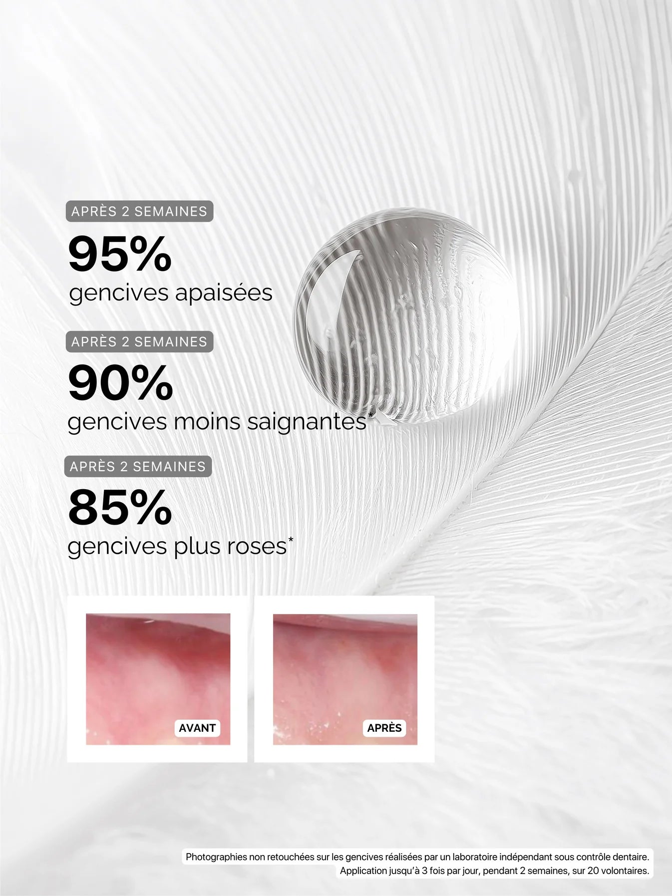 serum-gencives-regenerant-intense-the-smilist-maison-diaphane